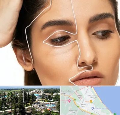 عمل بینی اقساطی در رودسر