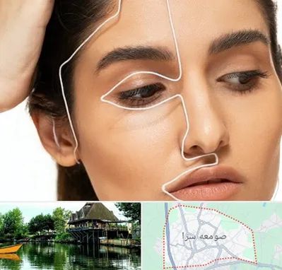 عمل بینی اقساطی در صومعه سرا