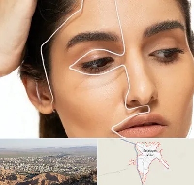 عمل بینی اقساطی در اسفراین