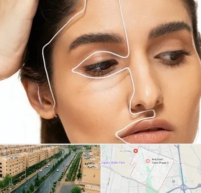 عمل بینی اقساطی در فاز سه اندیشه