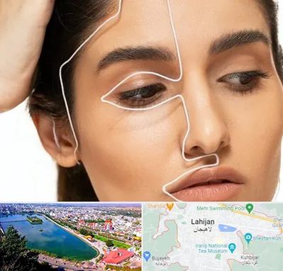 عمل بینی اقساطی در لاهیجان