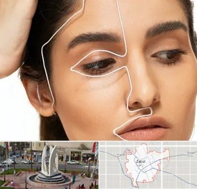 عمل بینی اقساطی در زابل