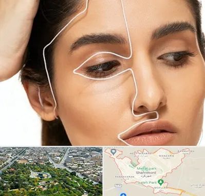 عمل بینی اقساطی در شهرکرد