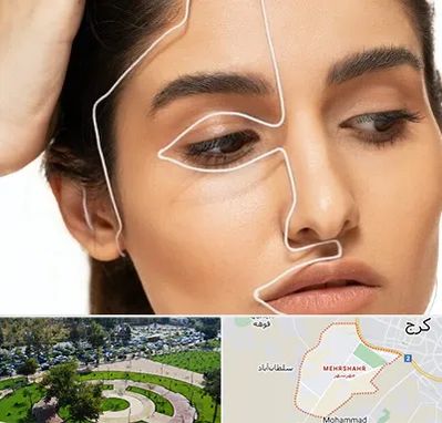 عمل بینی اقساطی در مهرشهر کرج 