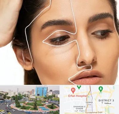 عمل بینی اقساطی در ونک 