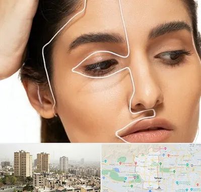 عمل بینی اقساطی در منطقه 5 تهران 