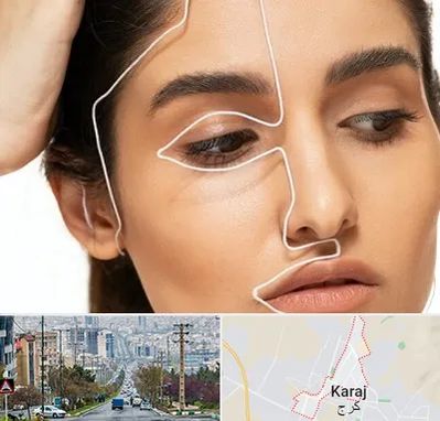 عمل بینی اقساطی در گوهردشت کرج 