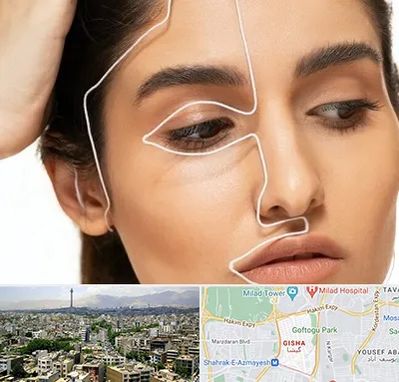 عمل بینی اقساطی در گیشا 