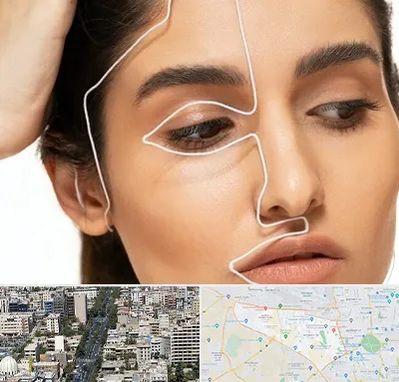 عمل بینی اقساطی در منطقه 18 تهران 