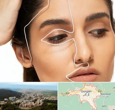 عمل بینی اقساطی در گرگان