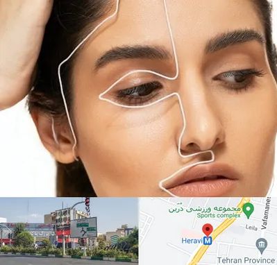 عمل بینی اقساطی در هروی 