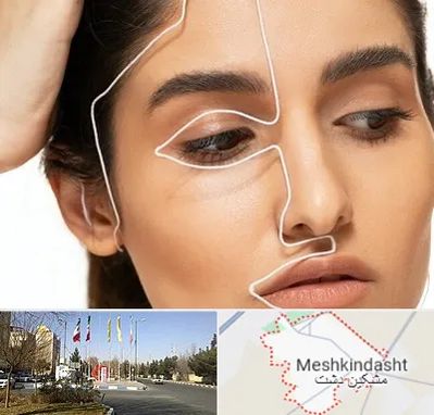 عمل بینی اقساطی در مشکین دشت