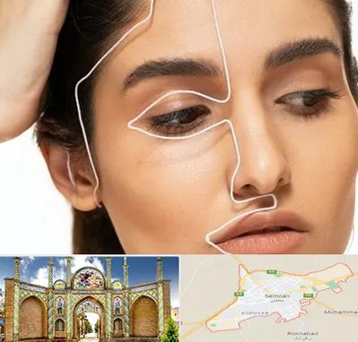 عمل بینی اقساطی در سمنان