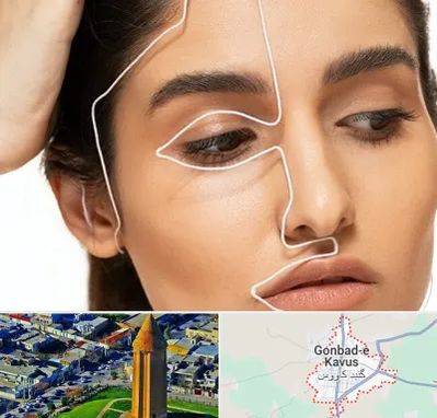 عمل بینی اقساطی در گنبد کاووس