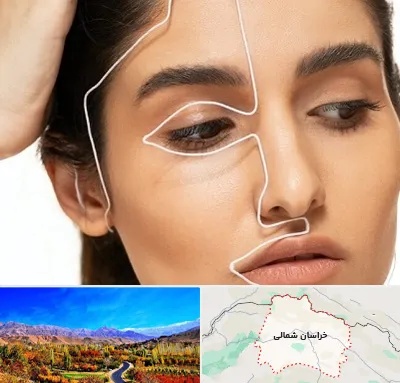 عمل بینی اقساطی در خراسان شمالی