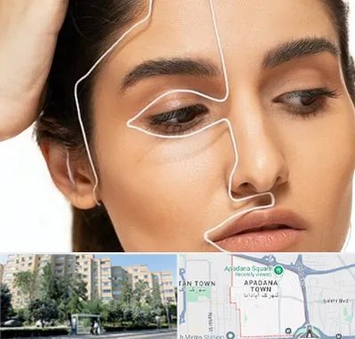 عمل بینی اقساطی در آپادانا