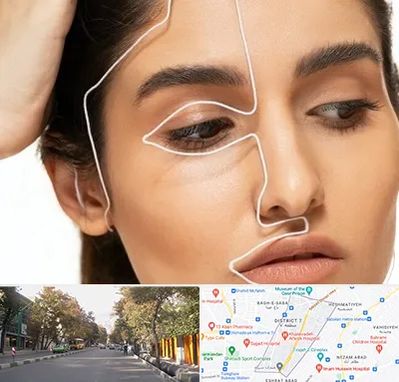 عمل بینی اقساطی در شریعتی 