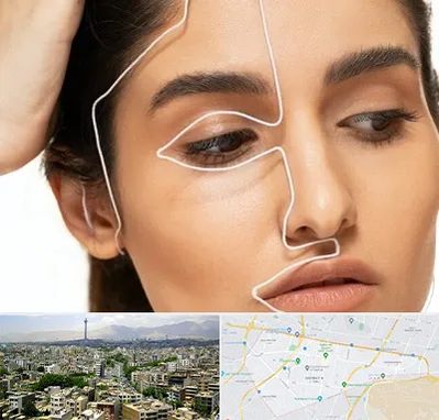عمل بینی اقساطی در منطقه 8 تهران 
