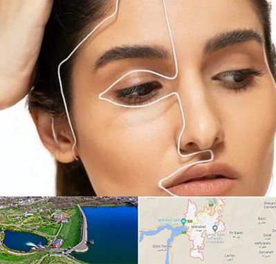 عمل بینی اقساطی در مهاباد