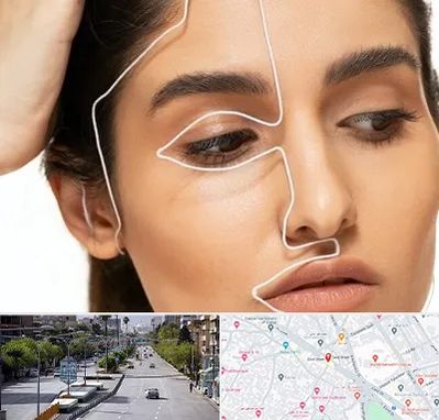 عمل بینی اقساطی در خیابان زند شیراز