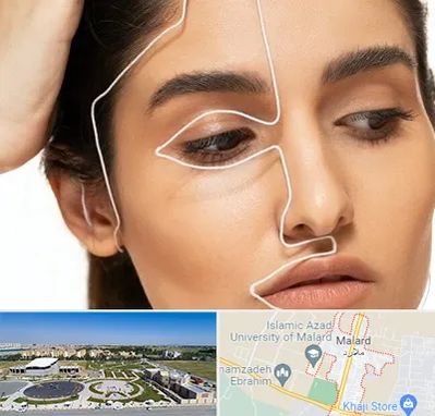 عمل بینی اقساطی در ملارد