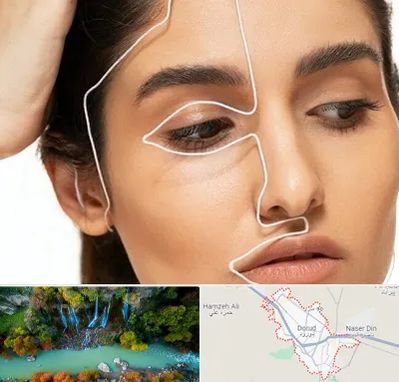 عمل بینی اقساطی در دورود