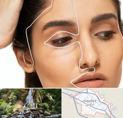 عمل بینی اقساطی در الیگودرز