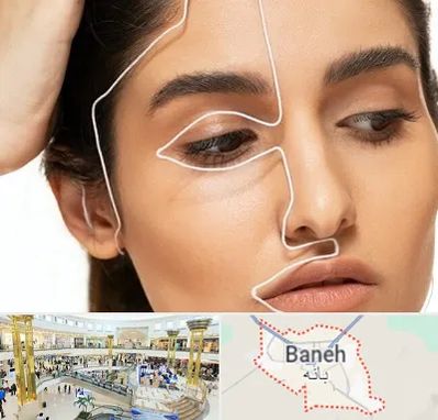 عمل بینی اقساطی در بانه