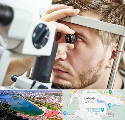 فوق تخصص قرنیه در لاهیجان