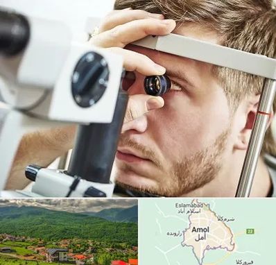 فوق تخصص قرنیه در آمل