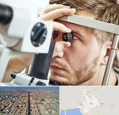 فوق تخصص قرنیه در بندر ماهشهر