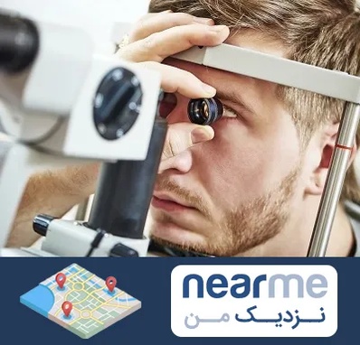 فوق تخصص قرنیه در نزدیک من