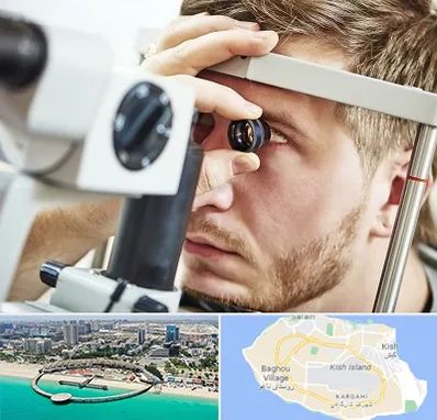 فوق تخصص قرنیه در کیش