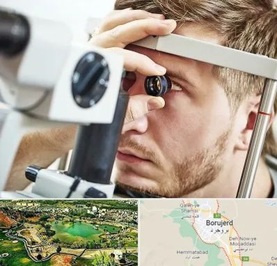 فوق تخصص قرنیه در بروجرد