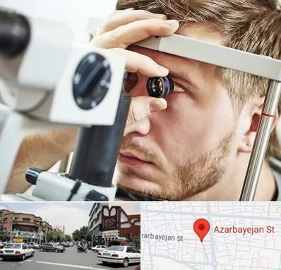 فوق تخصص قرنیه در خیابان آذربایجان