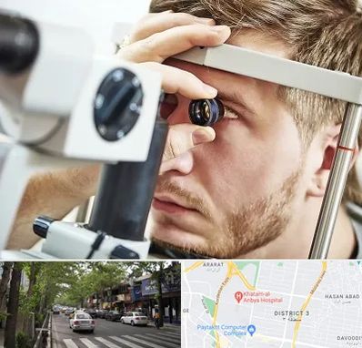 فوق تخصص قرنیه در ظفر 