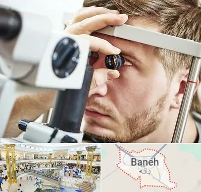 فوق تخصص قرنیه در بانه