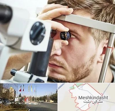 فوق تخصص قرنیه در مشکین دشت