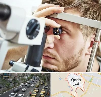 فوق تخصص قرنیه در شهر قدس