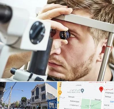 فوق تخصص قرنیه در افسریه 