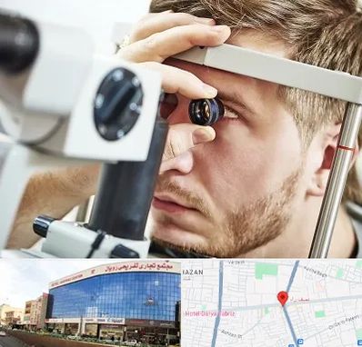 فوق تخصص قرنیه در نصف راه تبریز