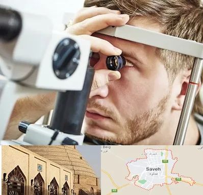 فوق تخصص قرنیه در ساوه