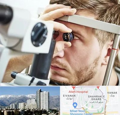 فوق تخصص قرنیه در شهرک غرب 