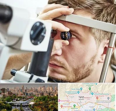 فوق تخصص قرنیه در منطقه 1 تهران 