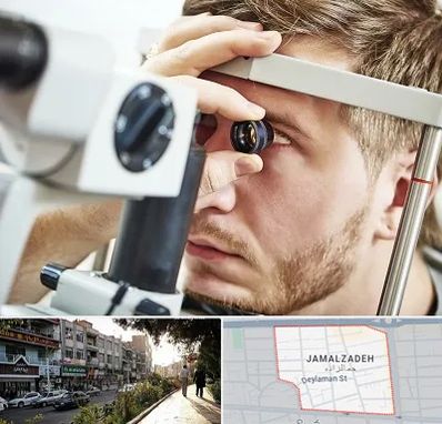 فوق تخصص قرنیه در خیابان جمالزاده