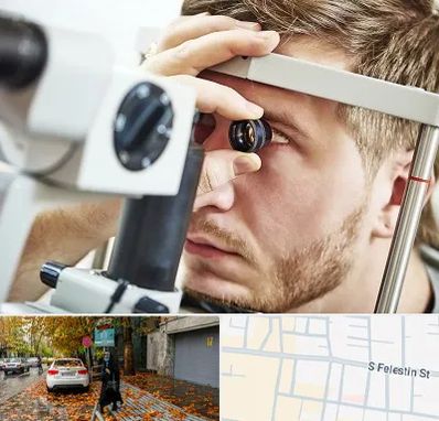 فوق تخصص قرنیه در خیابان فلسطین