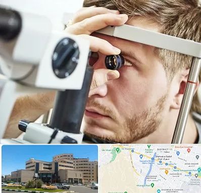 فوق تخصص قرنیه در صیاد شیرازی مشهد