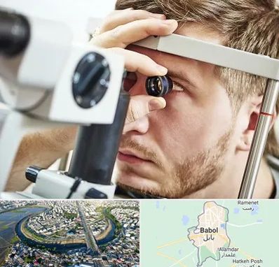 فوق تخصص قرنیه در بابل