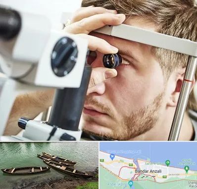 فوق تخصص قرنیه در بندر انزلی