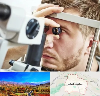 فوق تخصص قرنیه در خراسان شمالی